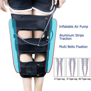 Adjustable O/X Type Legs Correction Band: A Solution for Bowed Legs & Knee Valgum Straightening
