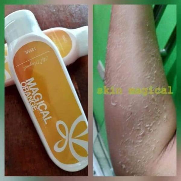 Skin Magical Orange Peel Lotion Lazada PH