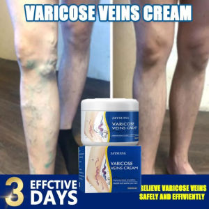 Kem Giãn Tĩnh Mạch Kem suy giãn tĩnh mạch giúp giảm đau mỏi Cải Thiện Lưu Thông Máu Giữ Lại Vẻ Đẹp Cho Đôi Chân