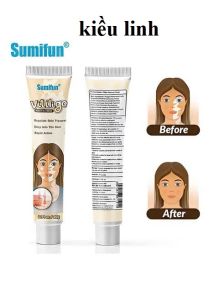 Kem Giảm Lang Ben Sumifun - Làm Đều Sắc Tố Vùng Da Bệnh Thích Hợp Dành Cho Tất Cả Mọi Người Hiệu Quả Và An Toàn