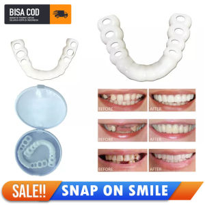 Snap On Smile Gigi Tiruan Lepasan Design Fleksibel Kuat dan TEMPTOOTH 50PCS Fungsional Memberikan Senyum Cantik Sehat Pada Gigi yang Bernoda Berjeda atau Hilang Perfect Smile yang Estetik
