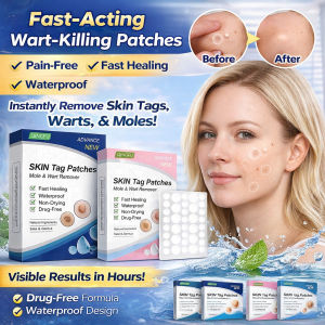 JMY Painless Fast Acting Pimple Patch Acne Treatment Wart Removal Skin Care Clear Skin Product