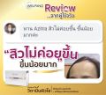 Welpano Azitra Plus  Product ผลิตภัณฑ์เสริมอาหารช่วยบำรุงและฟื้นฟูผิวขาวกระจ่างใสปรับสิวฮอร์โมนให้ลดลง. 