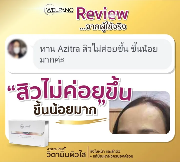 Welpano%20Azitra%20Plus%20%20Product%20%E0%B8%9C%E0%B8%A5%E0%B8%B4%E0%B8%95%E0%B8%A0%E0%B8%B1%E0%B8%93%E0%B8%91%E0%B9%8C%E0%B9%80%E0%B8%AA%E0%B8%A3%E0%B8%B4%E0%B8%A1%E0%B8%AD%E0%B8%B2%E0%B8%AB%E0%B8%B2%E0%B8%A3%E0%B8%8A%E0%B9%88%E0%B8%A7%E0%B8%A2%E0%B8%9A%E0%B8%B3%E0%B8%A3%E0%B8%B8%E0%B8%87%E0%B9%81%E0%B8%A5%E0%B8%B0%E0%B8%9F%E0%B8%B7%E0%B9%89%E0%B8%99%E0%B8%9F%E0%B8%B9%E0%B8%9C%E0%B8%B4%E0%B8%A7%E0%B8%82%E0%B8%B2%E0%B8%A7%E0%B8%81%E0%B8%A3%E0%B8%B0%E0%B8%88%E0%B9%88%E0%B8%B2%E0%B8%87%E0%B9%83%E0%B8%AA%E0%B8%9B%E0%B8%A3%E0%B8%B1%E0%B8%9A%E0%B8%AA%E0%B8%B4%E0%B8%A7%E0%B8%AE%E0%B8%AD%E0%B8%A3%E0%B9%8C%E0%B9%82%E0%B8%A1%E0%B8%99%E0%B9%83%E0%B8%AB%E0%B9%89%E0%B8%A5%E0%B8%94%E0%B8%A5%E0%B8%87%20-%20Image%206
