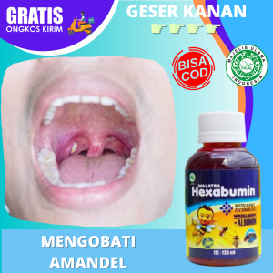 Obat Amandel Anak Mengempeskan Radang Amandel Ringan Parah Herbal Buat Mengecilkan Amandel Bengkak Di Rongga Tenggorokan Madu Buat Gejala Amandel Anak Usia 1 2 3 4 5 6 7 8 9 10 Tahun Penghilang Benjolan Amandel Kronis Di Leher - Hexabumin Halal BPOM