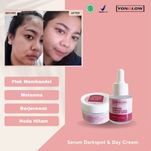 Paket 2in1 Serum Darkspot Day Cream Krim Siang Yonglow Skincare Formulasi dr Yong Serum Penghilang Flek Melasma Membandel Serum Penghilang Noda Hitam Pemutih Kulit Wajah Glowing Resmi BPOM