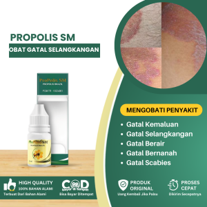 Obat Tetes Gatel Selangkangan Salep Gatal Selangkangan Obat Oles Kulit Gatal Jamur Eksim Obat Oles Gatel Selangkangan Kurok Panu Kudis Gatal - Propolis Sm