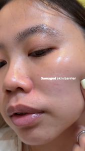 Tinh chất giảm mụn phục hồi da AXIS-Y ARTICHOKE INTENSIVE SKIN BARRIER AMPOULE