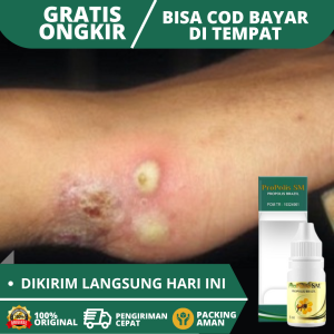 Obat Borok Obat Borok Bernanah Obat Borok di Kepala Obat Borok di Kaki Obat Borok di Tangan Obat Borok Alami biar Cepat Kering Obat Luka Infeksi Bernanah Obat Borok Anak Obat Borok Diabetes Obat Penghilang Bekas Borok di Kaki Dengan Propolis SM B