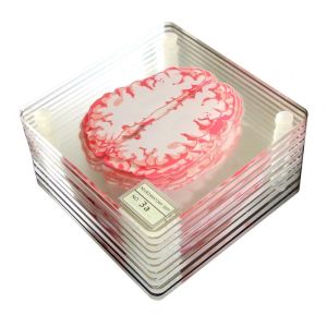 CHDHALTD Acrylic 3D Home Bar Slices Brain Scientists Gift Cup Mat Specimen Coasters Table Coaster Party Supplies