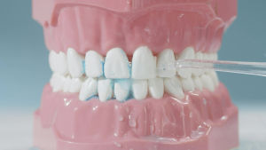 Shinesense Dental Water Flosser Sonic Electric Toothbrush Combo Kit with Rechargeable IPX7 Waterproof for Teeth Whitening Cleaning