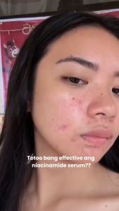 ✨Local Stock✨ Teashell Niacinamide Brightening Serum Whitening Fade Dark Spots Brighte Serum 5% Niacinamide & Alpha Arbutin COD