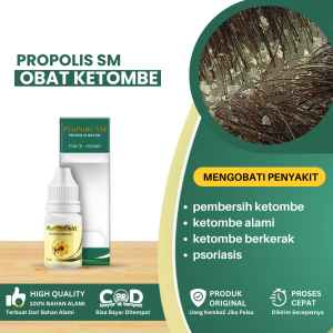 Obat Pembersih Ketombe Obat Ketombe Alami Obat Ketombe Parah Obat Penghilang Ketombe Obat Ketombe Berkerak Obat Ketombe Dan Rambut Rontok Obat Kulit Kepala Berkerak Obat Psoriasis Obat Ketombe Basah - Propolis SM