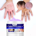 Antibacterial Cream Eczema Treatment Cream Atoderma Cream Original Fungisol Anti Fungal Cream Anti Itch Cream. 