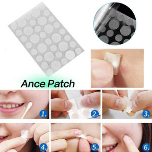 Miếng Dán Giảm Mụn Axit Salicylic 36 Miếng/ Acne Patch