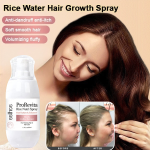 Rice Water Hair Growth Spray Anti Hair Loss Serum Spray Stimulate Hair Growth Improve Baldness for Men and Women