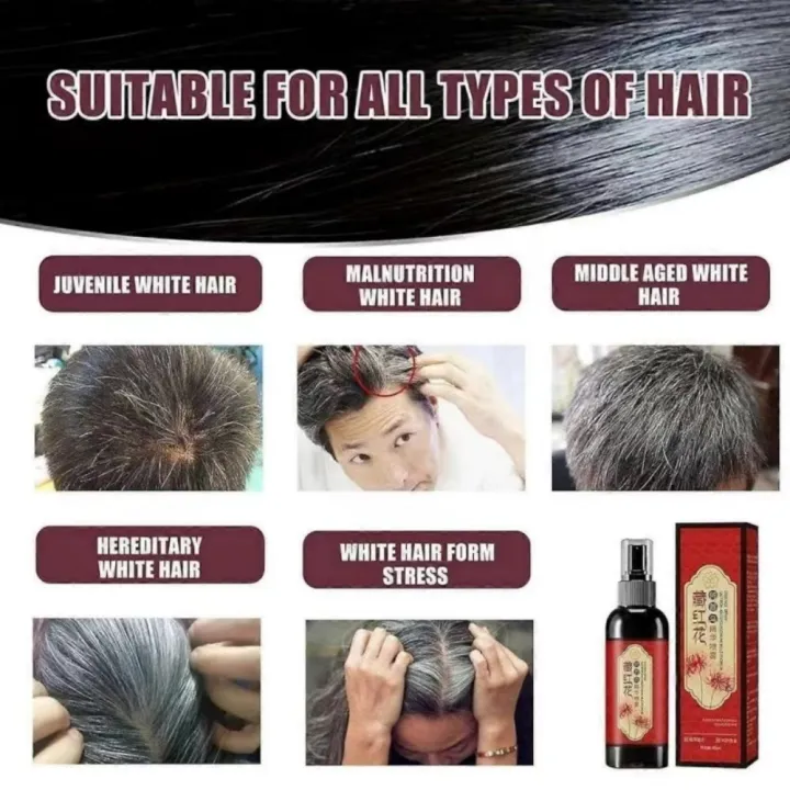 Saffron%20Hair%20Blackening%20Spray%20Black%20Ganoderma%20Lucidum%20Polygonum%20Multiflorum%20Original%20Herbal%20Extracts%20Hair%20Serum%20Promotes%20Hair%20Growth%20Covers%20Gray%20Hair%20Hair%20Conditioner%20Scalp%20Care%20Oil%20Control%20Anti-Hair%20Loss%20Portable%20Leave-in%20Spray%20Saffron%20Essence%20Spray%20-%20Image%208