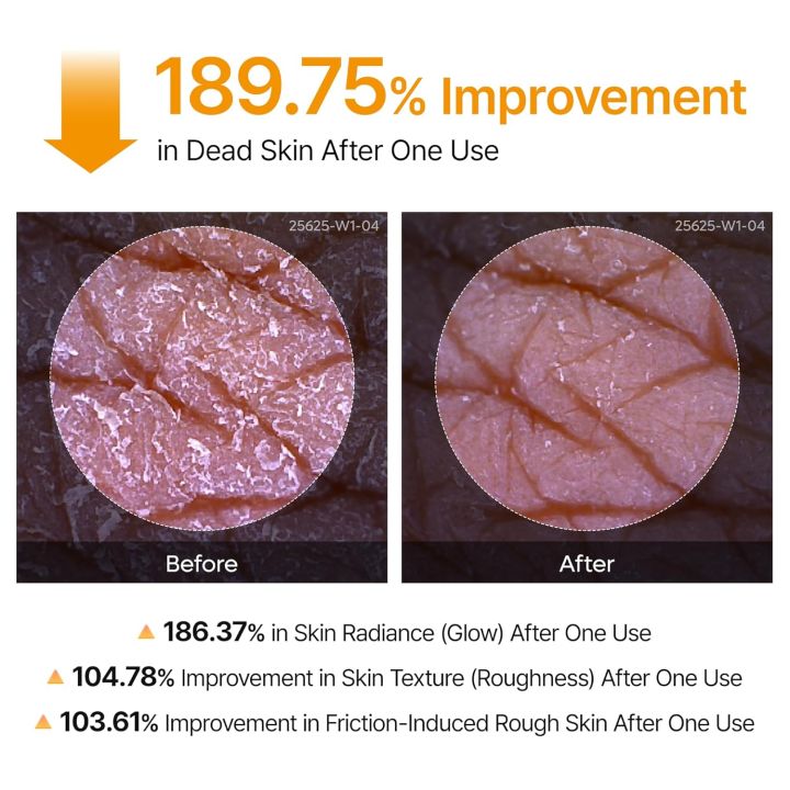 Dr.Melaxin%20Peel%20Shot%20Keratin%20Care%20Kojic%20Acid%20Turmeric%20Scrubs%20Spray%20200ml%20%7C%20Korean%20Cosmetics%20-%20Image%208