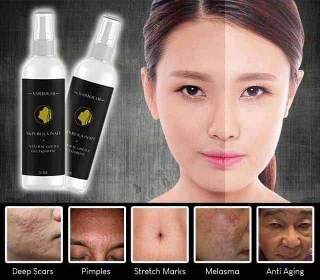 THE ORIGINAL VARTOUHI SKIN REJUVENATE + NATURAL GOLD & GLUTATHIONE /  VARTOUHI SKIN REJUVENATE GLUTATHIONE / VARTOUHI SKIN REJUVENATE GOLD /  MELASMA REMOVER / PEKAS REMOVER / SCAR REMOVER | Lazada PH