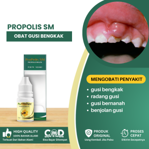Obat Sakit Gusi Bengkak Gusi Bengkak Di Sertai Nyeri Obat Nyeri Gusi Bernanah Gusi Ngilu Radang Gusi Obat Benjolan Di Gusi Polip Gusi Sakit Gusi Pipi Bengkak - Propolis SM