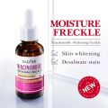 SADOER Freckle Serum Cream Remove Dark Spots on Face Melasma and Pekas Remover Original Pekas Remover Cream Original Dark Spot Remover Retinol Cream Original for Melasma Remover Anti Melasma Remover Cream Freckle Cream Whitening Facial Skin Care Cream. 