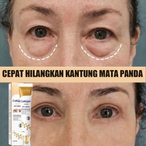 Collagen Eye Cream Mencerahkan mata 20g kantung mata penghilang Mata Panda Penghilang Kantung Mata Krim Mata Memudar Krim mata anti kerut Krim mata mencerahkan Menghilangkan lingkaran mata hitam Krim hot sale