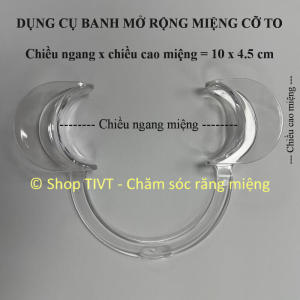 Dụng cụ hình chữ C giữ miệng mở rộng giúp banh mở miệng để rảnh tay làm các thao tác trong khoang miệng-TIVT