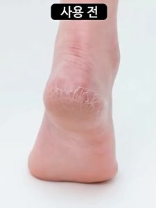 Vaseline Foot Cream/foot cream/Dry Hands Repair 50g moisturizer and cream Feet Exfoliate Chapped Feet Care Dead Skin Remover Foot Callus Remover 脚部龟裂去角质 hand and care 100% produk original