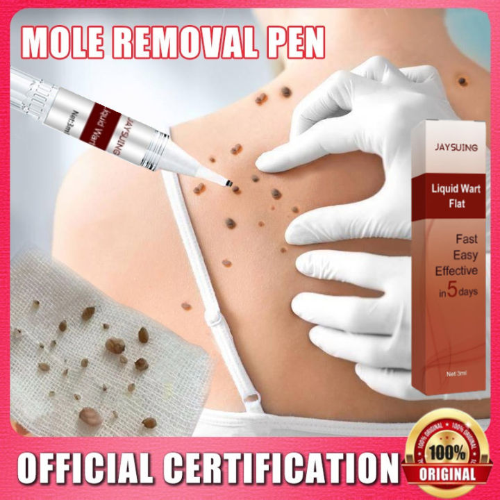 Skin Tag Pen Mole Corn Wart Removal Pen Obat Kutil Mata Calluse Remover Buang Tahi Lalat Ketuat