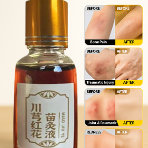 [Herbal Care] Chuanxiong Safflower Moxibustion Liquid Miao Family Secret Recipe Nurturing Essence川穹红花苗灸液