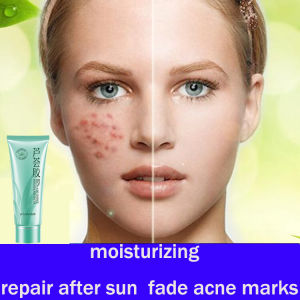 Aloe Vera Gel 92% Natural Face Creams Moisturizer Acne Treatment Gel for Skin Repairing