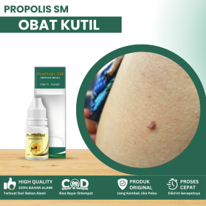 Obat Perontok Kutil Obat Penghilag Kutil Obat Perontok Kutil Seluruh Badan Obat Kutil Papiloma Obat Kutil Hitam Jengger Ayam Obat Benjolan Menonjol Obat Kutil Tidak Nyaman Dengan Propolis SM