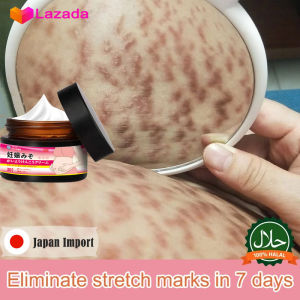 JEPAN Remove Stretch Mark Cream Pregnant Cream (Halal) Postpartum scar Remove Obesity Tattoo Care Firming Body Cream Stretch Marks Treatment