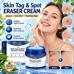Skin Growth Remover Cream Wart Care Skin Tag Treatment Cream Natural Extracts Blemish Care Face Body Skin Care