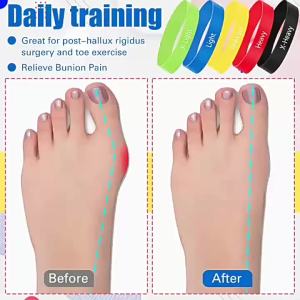 AE Spot Goods Tpe Hallux valgus correction elastic band yoga stretching resistance band corrective resistance elastic band