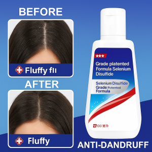 Shampoo Targeted Dandruff Scalp Care Prone to White Flakes Anti-dandruff and Anti-itching Simplicity