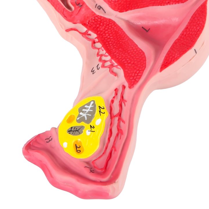 Fallopian Tube Model Label 1:1 Human Female Uterus Ovary Fallopian Tubes Model Anatomical Human ...