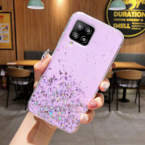 Phone case Vivo Y02t Y36 Y02A Y02 Y16 Y22 Y35 starry sky design thin and clear soft silicone phone casing Vivo Y36 5G Phone cover