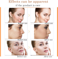 Serum Wajah Vitamin C Serum Orange Vit C dan E 30ML Original Forte Dus Oranye/Kuning Mencerahkan Anti Oksidan Setara. 