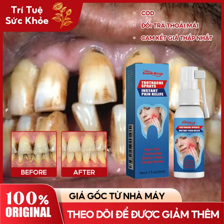 SOUTH MOON Xịt chống sâu răng Xịt giảm đau răng tức thì Toothache Spray 20ml