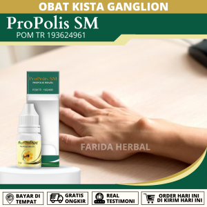 Obat Penghilang Benjolan Ganglion Obat Penghancur Ganglion Obat Benjolan Lipoma Obat Benjolan Di Tangan Obat Kista Ganglion Tumor Jinak Benjolan Keras Berisi Cairan Benjolan Di Pergelangan Sendi Obat Herbal Kista Ganglion dengan Propolis SM