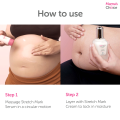 Mama’s Choice Stretch Mark Treatment Series | Stretch Mark Cream and Serum | No Paraben and Alcohol. 