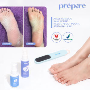 PREPARE Foot Cream Solution Perawatan Kaki Kering Tumit Pecah Pecah dan Kapalan Foot Soak Concentrate