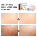 EELHOE Pigment Correcting Cream Freckles Removal Cream Pigment Correcting Serum Remove Melasma Age Spots Sunspots Whitening Freckle Removing Cream Effective Brightening Essence Remove Pigment Melanin Correct Beauty Facial Skin Care. 
