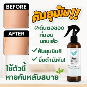 สเปรย์กำจัดไรฝุ่น กำจัดไรฝุ่น สเปรย์กำจัดไร สเปรย์ไรฝุ่น สเปรย์กันไรฝุ่น กำจัดไรด้วยสูตรพืช สเปรย์ฆ่าไรฝุ่น ใช้ได้ทั้งเด็กและคนท้อง ไม่ต้องซัก เตียง โซฟา รังสัตว์เลี้ยง dust mites spray