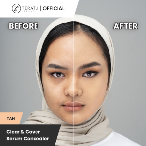 TERATU BEAUTY Clear & Cover Serum Concealer (Concealer Aman Untuk Kulit Berjerawat Non Comedogenic)