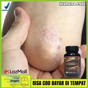Obat Psoriasis Prosiasis Kulit Kepala Obat Gatal Badan Kudis Badan Penghilang Gatal Di Badan Gatal selangkangan Prosiasis Menahun Atasi Dengan Proskin Sehat Kulit 100% Original BPOM & HALAL MUI