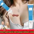 Penghilang Bekas Luka -Menghilangkan bekas luka lama di kaki-Menghilangkan bekas luka hitam-Menghilangkan bekas luka di wajah-Menghilangkan bekas luka lama-Cream penghilang bekas luka permanen-Cream penghilang bekas luka koreng hitam. 