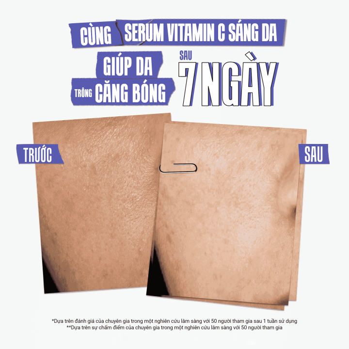 Serum%20Vitamin%20C%20l%C3%A0m%20s%C3%A1ng%20da%20&%20m%E1%BB%9D%20th%C3%A2m%20m%E1%BB%A5n%20Kiehl's%20Clearly%20Corrective%E2%84%A2%20Dark%20Spot%20Solution%2050ml%20-%20Image%203
