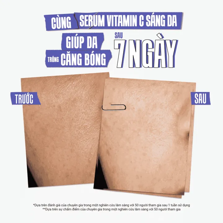 Serum%20Vitamin%20C%20l%C3%A0m%20s%C3%A1ng%20da%20&%20m%E1%BB%9D%20th%C3%A2m%20m%E1%BB%A5n%20Kiehl's%20Clearly%20Corrective%E2%84%A2%20Dark%20Spot%20Solution%2050ml%20-%20Image%203